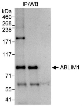 Rabbit ABLIM1 Antibody