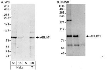 Rabbit ABLIM1 Antibody