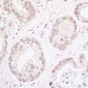 Rabbit ARID2 Antibody