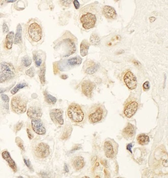 Rabbit HBO Antibody