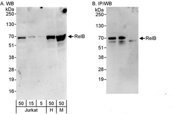 Rabbit RelB Antibody