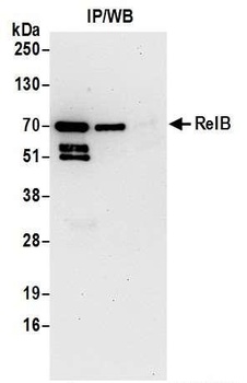 Rabbit RelB Antibody