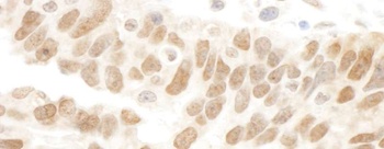 Rabbit Abraxas Antibody