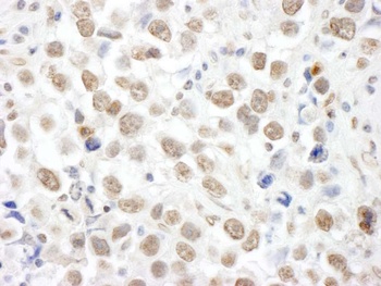 Rabbit TOPORS Antibody