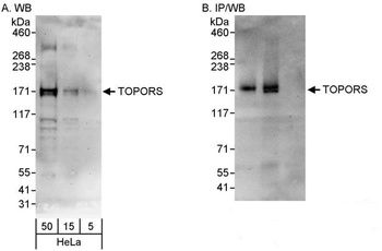 Rabbit TOPORS Antibody