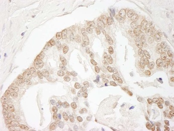 Rabbit GIT2 Antibody