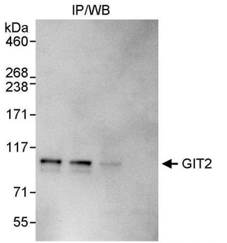 Rabbit GIT2 Antibody