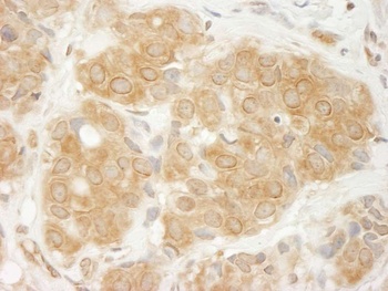 Rabbit GIT1 Antibody