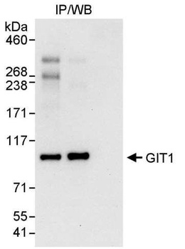 Rabbit GIT1 Antibody