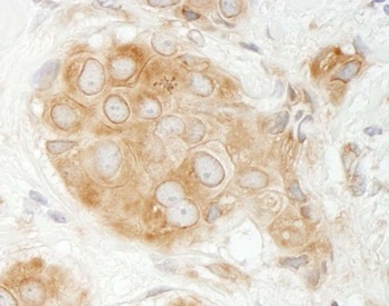 Rabbit GIT1 Antibody