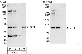 Rabbit GIT1 Antibody