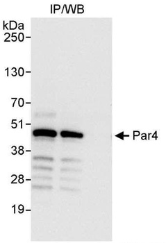Rabbit Par4 Antibody