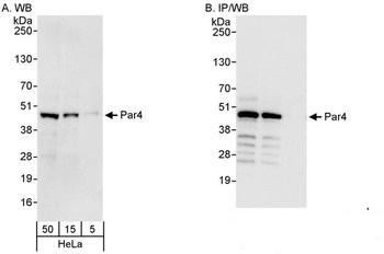 Rabbit Par4 Antibody