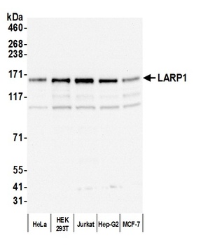 Rabbit LARP1 Antibody