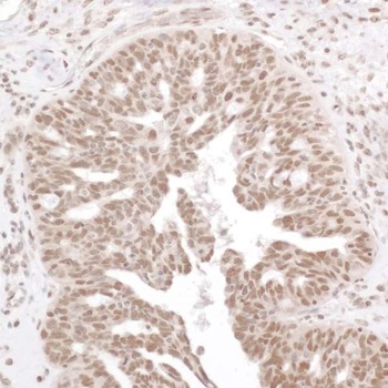 Rabbit Phospho RelA (S536) Antibody