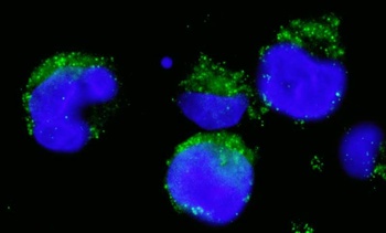 Rabbit BCR Antibody