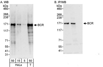 Rabbit BCR Antibody