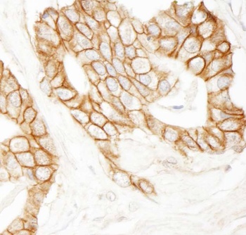 Rabbit beta Catenin Antibody