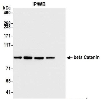 Rabbit beta Catenin Antibody