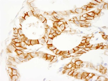 Rabbit beta Catenin Antibody