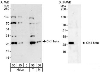 Rabbit anti-CKII beta Antibody