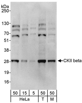 Rabbit anti-CKII beta Antibody