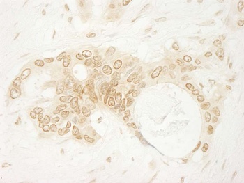 Rabbit ARHGEF16 Antibody