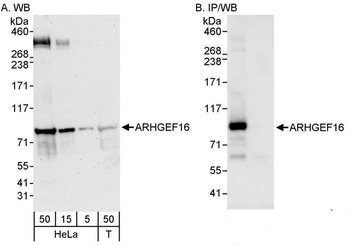 Rabbit ARHGEF16 Antibody