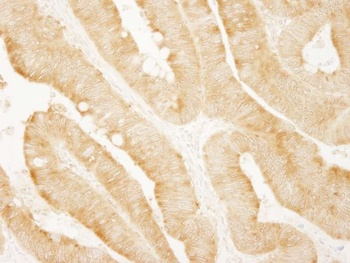 Rabbit vPARP Antibody