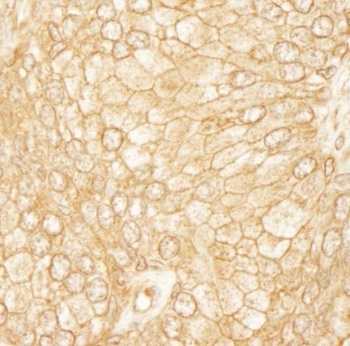 Rabbit PDZ-RhoGEF Antibody