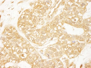 Rabbit PDZ-RhoGEF Antibody