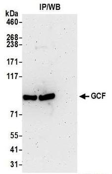 Rabbit GCF Antibody