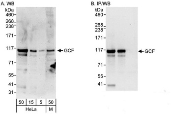 Rabbit GCF Antibody