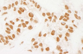 Rabbit NELFE Antibody