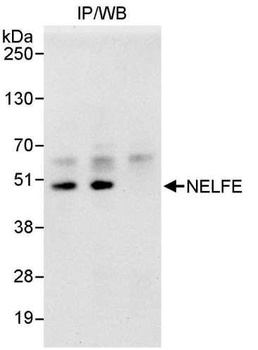 Rabbit NELFE Antibody