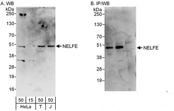 Rabbit NELFE Antibody