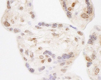 Rabbit NELFA Antibody