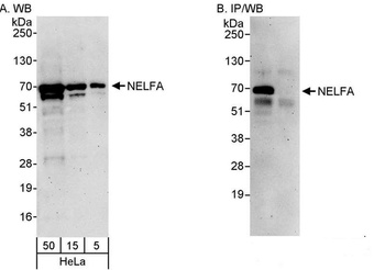 Rabbit NELFA Antibody