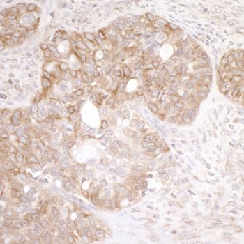 Rabbit EML4 Antibody