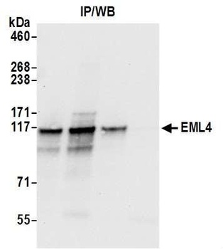 Rabbit EML4 Antibody