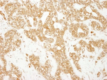 Rabbit EEA1 Antibody