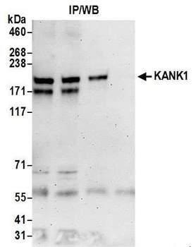 Rabbit KANK1 Antibody