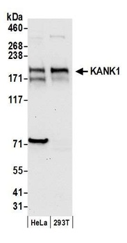 Rabbit KANK1 Antibody