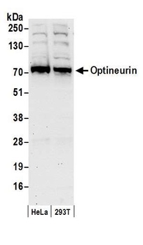 Rabbit Optineurin Antibody