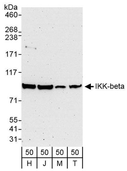 Rabbit IKK-beta Antibody