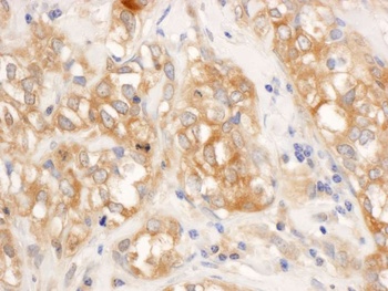 Rabbit RelA Antibody