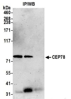 Rabbit CEP78 Antibody