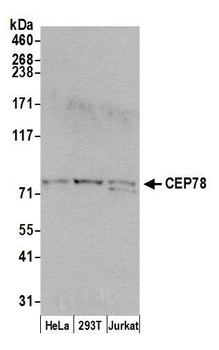 Rabbit CEP78 Antibody