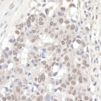 Rabbit NCBP1/CBP80 Antibody
