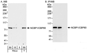 Rabbit NCBP1/CBP80 Antibody